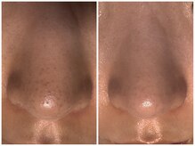 サラグランデ(Sara Grande)/お客様ビフォーアフターです！