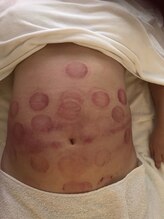 中国整体 らくらく堂/温熱療法オイルリンパマッサージ