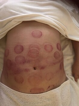 中国整体 らくらく堂/温熱療法オイルリンパマッサージ