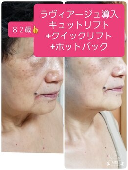 キレイとケンコウの応援サロン杉山/いつからでもきれいに♪