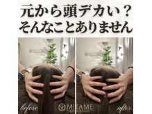ミタメ 銀座店(MITAME)/頭から小さくなる美小顔矯正♪