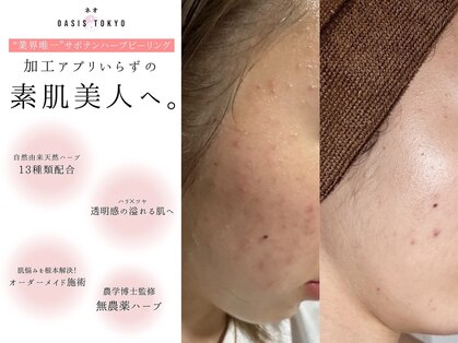 ネオオアシス トウキョウ(ネオOASIS TOKYO)の写真