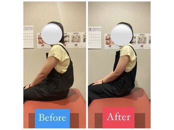 ナオル整体 宮崎院(NAORU整体)/30代女性施術事例【猫背改善】