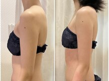 オールハンドで短期間効果◎全身コース多数ご用意！【銀座店】