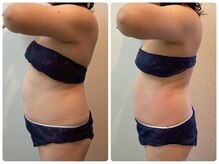 鍼灸整骨院ナガサキ(nagasaki)/ウルトランスフォーマー