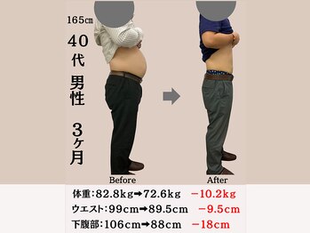 穴田鍼灸整骨院/【40代　男性】ダイエット