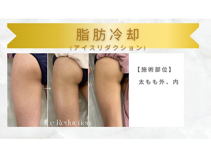 エステティックサロン フェアリー(ESTHETIC SALON FAIRLY)の写真