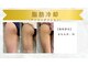 エステティックサロン フェアリー(ESTHETIC SALON FAIRLY)の写真