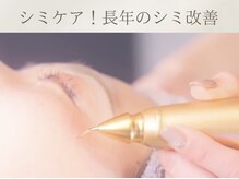 フェイシャルサロン ベルダ(BELDA)の雰囲気（気になるシミに集中アプローチ！ 隠すより、澄みわたる素肌へ♪）