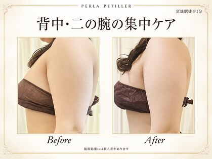 ペルラペティーユ(PERLA PETILLER)の写真