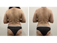 ラナビューティリゾート(Lana Beauty resort)/エステ担当★50代