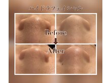 サロン エム(saron M)