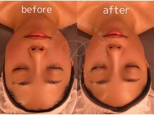 R-1ビューティーサロン 表参道/Before＆After