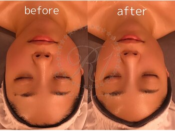 R-1ビューティーサロン 表参道/Before&After