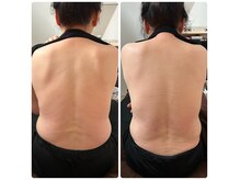 サロン ルチア(Salon LUCIA.)の雰囲気（【漢方温活泥湿布×ボディケア】むくみの緩和、姿勢改善に◎）