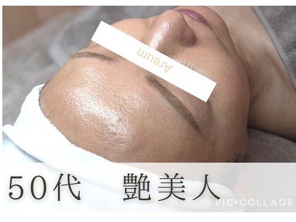 アルム(Areum)の写真