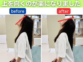 整体×パーソナルトレーニングREHASUL【リハスル】肩こり 大平台店【12/17 OPEN予定】/上を向いた時の違和感が改善！
