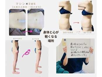 ネオボディ(Neo Body)