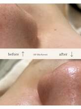 オフオルファヴォリ(OF Olu:Favori)/【フラッシュワックス脱毛】