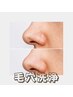 【6月限定キャンペーン】いちご鼻や毛穴黒ずみ角栓の悩み解決¥6,600→¥4,400