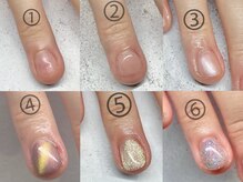 プチムトン 鶯谷店(petit mouton)/【深爪矯正コース】6