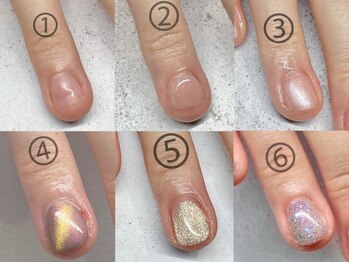 プチムトン 鶯谷店(petit mouton)/【深爪矯正コース】6