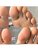 フットミー(foot mii)/