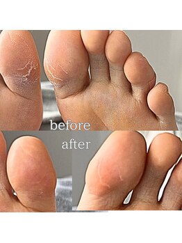 フットミー(foot mii)/