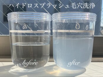 ブルーム(Bloom.)/ハイドロスプラッシュ毛穴洗浄