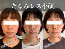 フレキシボディ(FlexiBody)の雰囲気（小顔矯正整体で中顔面のもたつき解消！すっきりした小顔へ！）