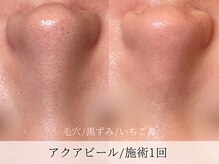 ミューズ バイ エス(MUSE BY S)/