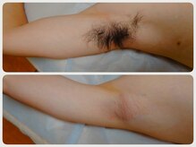 キナリ(kinari)の雰囲気（ワキはワックス＋光のダブル脱毛で毛量を減らすのがオススメです）