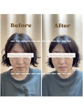 大門鍼灸整骨院/美容鍼施術後ビフォーアフター