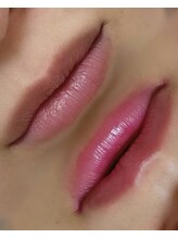 ダリア(Dahlia)/次世代ピンクトーン施術