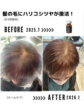 サンシー整体(SunCY整体)/４０代女性