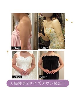 ラトナ(Ratna)の写真/【口コミ圧倒的高評価★結果満足度◎】見た目の変化に感動の声続出★女性らしい美ボディに大変身♪