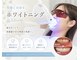 リノ(Lino)の写真/初めての方にもおすすめのセルフホワイトニング！輝く白い歯で自信あふれる笑顔へ！