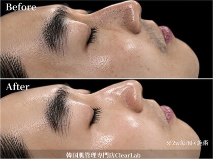 クリアラボ 池袋(Clear Lab)の写真