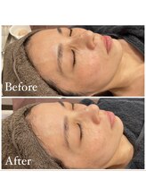 リノベル(LINOBELLE)/季節の変わり目にはこれ！！