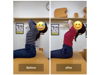 ナオル整体 飯田橋院(NAORU整体)/Before After/飯田橋