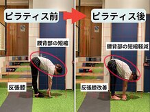 ファクト(fact)/XO脚、反張膝が気になる方