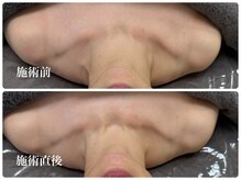 シェミー(CHEZ MEE)/美肌・小顔の近道は【デコルテ】