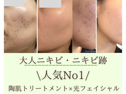 ファシル(Facile)の写真