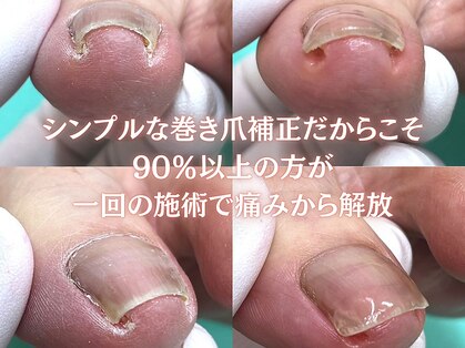 巻き爪補正店 大阪京橋店の写真