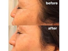 アースコアフュールボーテ 小山店(EARTH coiffure beaute)の雰囲気(肌トラブルご相談下さい★esthetician上野【毛穴/フェイシャル】)