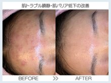 フェアリー(fairy)/