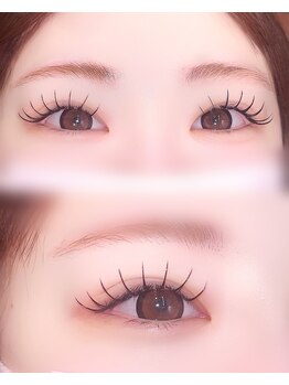 フィーネアイ 八戸(Fi-Ne eye)/LEDフラット150