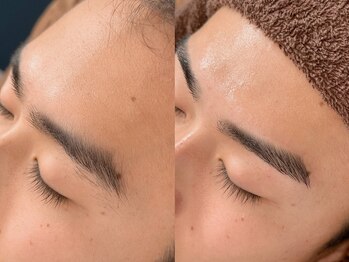 エムズハグ(M's hug)/眉毛ワックス/繋がり眉が悩み