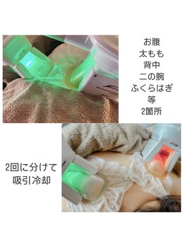 ラ ブリエ(La Briller)/脂肪冷却4カップ♪