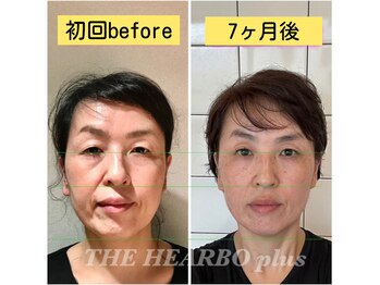 ハーボプラス(THE HEARBO plus)/キレイをKeep出来てます♪